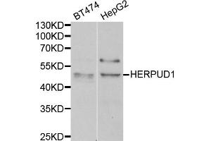 Western blot analysis of extracts of BT474 and HepG2 cell lines, using HERPUD1 antibody.