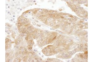 Immunohistochemistry (IHC) image for anti-TSC22 Domain Family, Member 1 (TSC22D1) (AA 1023-1073) antibody (ABIN7454932)