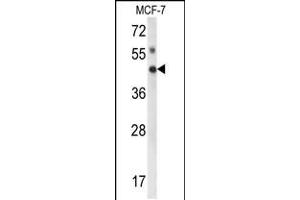 Western blot analysis of IPMK Antibody in MCF-7 cell line lysates (35ug/lane) (IPMK 抗体  (AA 300-329))