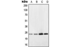 Western blot analysis of NDUFV2 expression in A431 (A), Ramos (B), HepG2 (C), NIH3T3 (D) whole cell lysates. (NDUFV2 抗体  (Center))