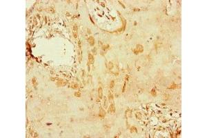 Immunohistochemistry of paraffin-embedded human placenta tissue using ABIN7150406 at dilution of 1:100 (CCDC111 抗体  (AA 305-537))