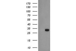 Western Blotting (WB) image for anti-Exosome Component 3 (EXOSC3) antibody (ABIN1498138) (EXOSC3 抗体)