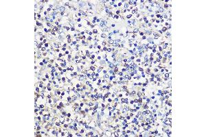 Immunohistochemistry of paraffin-embedded human spleen using CD80 Rabbit pAb (ABIN7266220) at dilution of 1:100 (40x lens). (CD80 抗体  (AA 1-100))