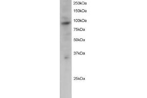 Western Blotting (WB) image for anti-PML-RARA Regulated Adaptor Molecule 1 (PRAM1) (C-Term) antibody (ABIN2466137) (PRAM1 抗体  (C-Term))