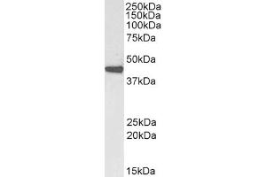Western Blotting (WB) image for anti-Actin, alpha 2, Smooth Muscle, Aorta (ACTA2) (N-Term) antibody (ABIN185271)
