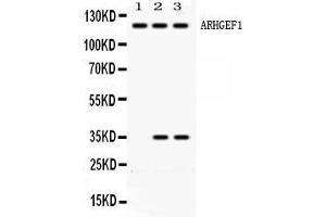 Western blot analysis of ARHGEF1 expression in rat brain extract ( Lane 1), HELA whole cell lysates ( Lane 2) and JURKAT whole cell lysates ( Lane 3).