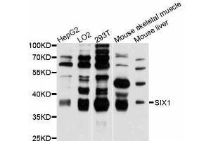 Western blot analysis of extracts of various cell lines, using SIX1 antibody (ABIN5998814) at 1:3000 dilution. (SIX Homeobox 1 抗体)