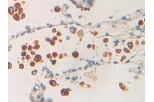 Detection of PLA1 in Human Lung Tissue using Polyclonal Antibody to Phospholipase A1 (PLA1) (PLA1A 抗体  (AA 309-452))