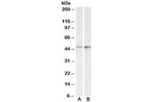 Western blot testing of A431 [A] and HeLa [B] lysates with E2F4 antibody at 0. (E2F4 抗体)