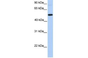 GALNT13 antibody used at 1 ug/ml to detect target protein. (GALNT13 抗体  (N-Term))