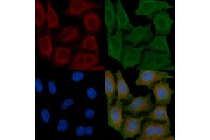 ABIN6260985 and ABIN6266912 staining Hela cells(45 min of heat-shock) by IF/ICC. (COX17 抗体  (N-Term))