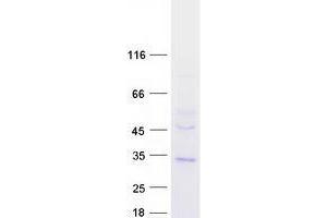 Western Blotting (WB) image for Transmembrane Protein 38B (TMEM38B) protein (Myc-DYKDDDDK Tag) (ABIN2733895)