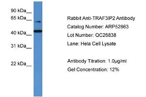 WB Suggested Anti-TRAF3IP2  Antibody Titration: 0.