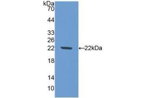 Western blot analysis of recombinant Mouse NOS1. (NOS1 抗体  (AA 53-247))