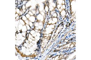 Immunohistochemistry (IHC) image for anti-Basic Helix-Loop-Helix Family, Member E40 (BHLHE40) (AA 173-412) antibody (ABIN6137550)