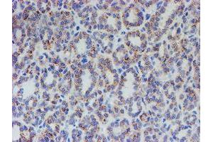 Image no. 1 for anti-Acyl-CoA Synthetase Family Member 2 (ACSF2) antibody (ABIN1496423) (ACSF2 抗体)