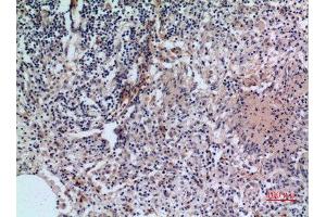 Immunohistochemistry (IHC) analysis of paraffin-embedded Human Lung, antibody was diluted at 1:100. (CD38 抗体  (Internal Region))