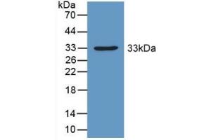Detection of Recombinant PDHX, Mouse using Polyclonal Antibody to Pyruvate Dehydrogenase Complex Component X (PDHX) (PDHX 抗体  (AA 222-471))