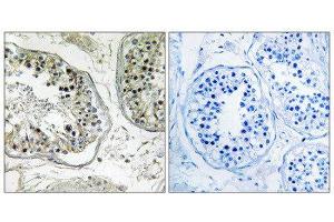 Immunohistochemistry (IHC) image for anti-Carbohydrate (Chondroitin 4) Sulfotransferase 13 (CHST13) (Internal Region) antibody (ABIN1850992) (CHST13 抗体  (Internal Region))