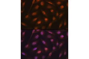Immunofluorescence analysis of U-2 OS cells using K48-linkage Specific Ubiquitin Rabbit mAb (ABIN1680189, ABIN3017871, ABIN3017872 and ABIN7101530) at dilution of 1:100 (40x lens). (Ubiquitin B 抗体)