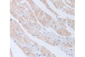 IHC-P analysis of Mouse Tissue, with DAB staining. (BMP5 抗体  (AA 315-452))