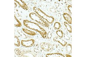 Immunohistochemistry of paraffin-embedded human kidney using IDH1 Rabbit mAb (ABIN7268027) at dilution of 1:500 (40x lens). (IDH1 抗体)