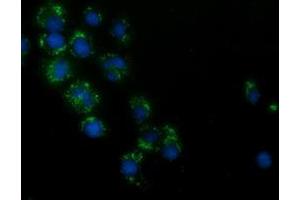 Anti-HAO1 mouse monoclonal antibody (ABIN2453105) immunofluorescent staining of COS7 cells transiently transfected by pCMV6-ENTRY HAO1 (RC216834). (HAO1 抗体)