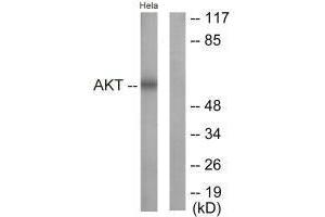 Western Blotting (WB) image for anti-V-Akt Murine Thymoma Viral Oncogene Homolog 1 (AKT1) (Tyr326) antibody (ABIN7179970)