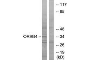 Western Blotting (WB) image for anti-Olfactory Receptor, Family 9, Subfamily G, Member 4 (OR9G4) (AA 278-327) antibody (ABIN2891063) (OR9G4 抗体  (AA 278-327))
