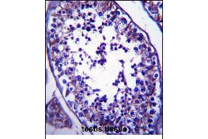 SLC27A3 Antibody (N-term) (ABIN657380 and ABIN2846425) immunohistochemistry analysis in formalin fixed and paraffin embedded human testis tissue followed by peroxidase conjugation of the secondary antibody and DAB staining. (SLC27A3 抗体  (N-Term))