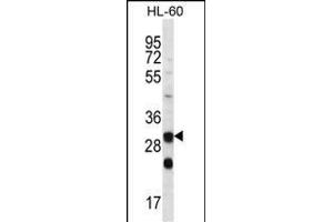CA6 Antibody (C-term) (ABIN656592 and ABIN2845853) western blot analysis in HL-60 cell line lysates (35 μg/lane). (CA6 抗体  (C-Term))