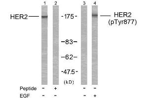 Western blot analysis of extract from MDA-MB-231 cells treated or untreated with EGF using HER2 (Ab-877) Antibody (E021070, Line 1 and 2) and HER2 (phospho-Tyr877) antibody (E011075, Line 3 and 4). (ErbB2/Her2 抗体  (pTyr877))