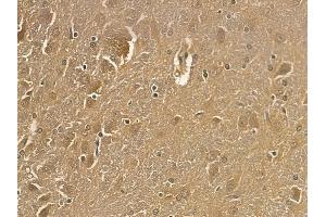 SNPH Mouse Monoclonal Antibody at 1/100 staining rat brain tissue by IHC-P. (Syntaphilin 抗体)