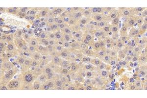 Detection of DBI in Mouse Liver Tissue using Polyclonal Antibody to Diazepam Binding Inhibitor (DBI)