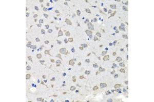 Immunohistochemistry of paraffin-embedded mouse brain using C1GALT1C1 antibody at dilution of 1:100 (x40 lens). (C1GALT1C1 抗体)