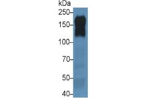Mouse Capture antibody from the kit in WB with Positive Control: Sample Human A431 cell lysate;. (EGFR ELISA 试剂盒)