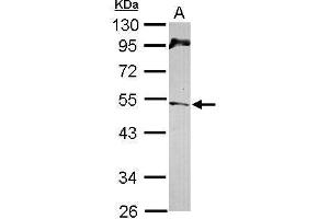 WB Image Sample (30 ug of whole cell lysate) A: NT2D1 10% SDS PAGE antibody diluted at 1:1000 (CHEK1 抗体  (C-Term))