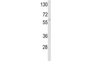 Western Blotting (WB) image for anti-Plasminogen Activator, Tissue (PLAT) (AA 371-399) antibody (ABIN3032243)
