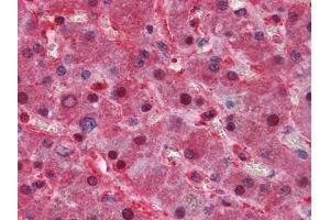 Immunohistochemical analysis of paraffin-embedded human Liver tissues using LPA antibody (Apo(a) 抗体)