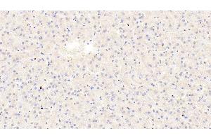 Immunohistochemistry (IHC) image for anti-Transient Receptor Potential Cation Channel, Subfamily A, Member 1 (TRPA1) (AA 63-370) antibody (ABIN7441301)