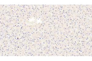 Detection of TRPA1 in Human Liver Tissue using Polyclonal Antibody to Transient Receptor Potential Cation Channel Subfamily A, Member 1 (TRPA1) (TRPA1 抗体  (AA 63-370))