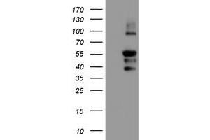 HEK293T cells were transfected with the pCMV6-ENTRY control (Left lane) or pCMV6-ENTRY PPP1R15A (Right lane) cDNA for 48 hrs and lysed. (GADD34 抗体)