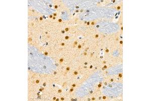 Immunohistochemistry (Paraffin-embedded Sections) (IHC (p)) image for anti-Fibroblast Growth Factor 11 (FGF11) antibody (ABIN7073941)