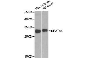 Western blot analysis of extracts of mouse heart and rat heart cell lines, using SPATA4 antibody. (SPATA4 抗体)