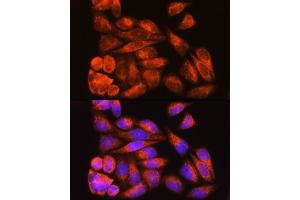 Immunofluorescence analysis of HeLa cells using ODF2 Rabbit pAb (ABIN7269128) at dilution of 1:100. (ODF2 抗体  (AA 630-829))