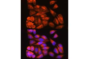 Immunofluorescence analysis of HeLa cells using ODF2 Rabbit pAb (ABIN7269128) at dilution of 1:100. (ODF2 抗体  (AA 630-829))
