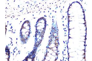 Immunohistochemistry of paraffin-embedded human colon using MB/MB/ML2 Rabbit mAb (ABIN1679325, ABIN3019109, ABIN3019110 and ABIN7101716) at dilution of 1:100 (40x lens). (MAD2L2 抗体)
