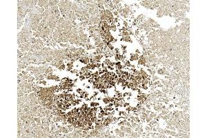 Immunohistochemical analysis of paraffin-embedded Human pancreas section using Pink1 (ABIN6244274 and ABIN6577058). (ENO2/NSE 抗体)