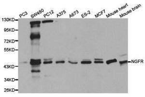 Western Blotting (WB) image for anti-Nerve Growth Factor Receptor (NGFR) antibody (ABIN1873905) (NGFR 抗体)
