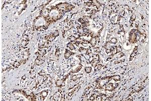 IHC analysis of FEN1 using anti-FEN1 antibody (ABIN7601618).
